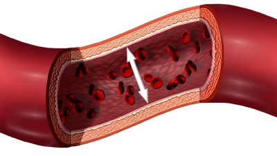 Hipertensión Arterial. Ilustración de la Presión Arterial